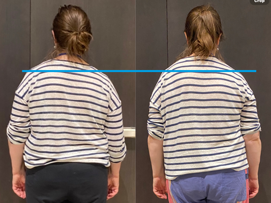 Spinal flow shoulders